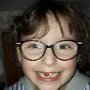 perte de dents (1)